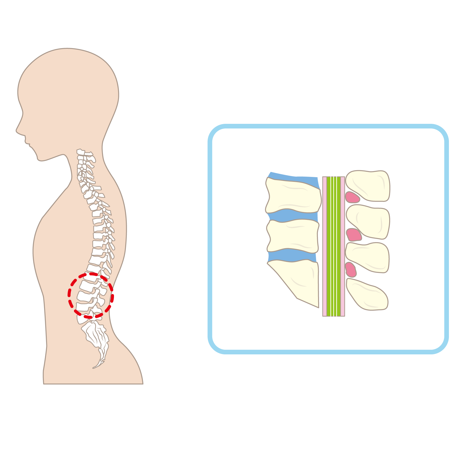腰椎と脊柱管のイラスト